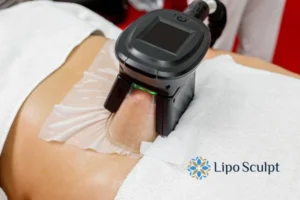 Fat freezing at home from Lipo Sculpt Oldham